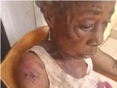 At 90, Abia widow fights for life amid repeated assault by brother’s wife, kids